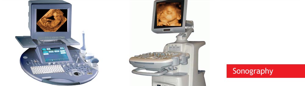 sonography